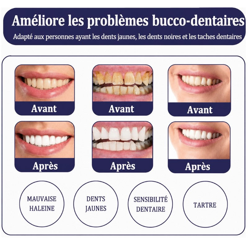 White X blanchiment des dents
