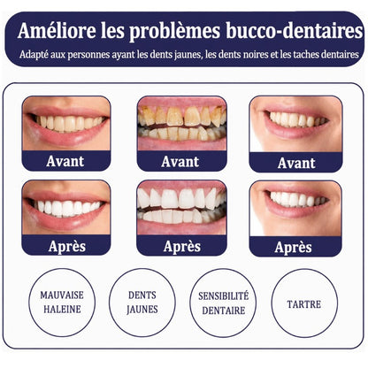 White X blanchiment des dents