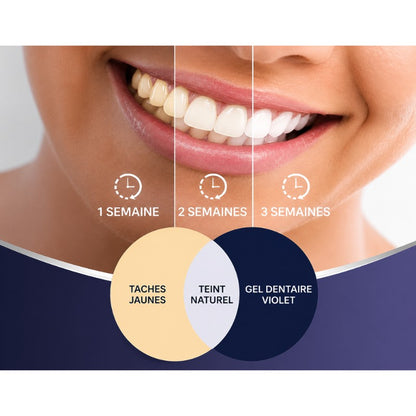 White X blanchiment des dents